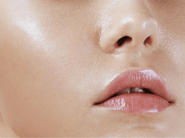 Oily Summer Skin and 6 Ways to Fix It